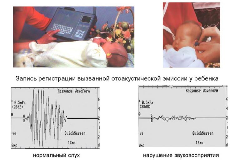 Генератор проверки слуха